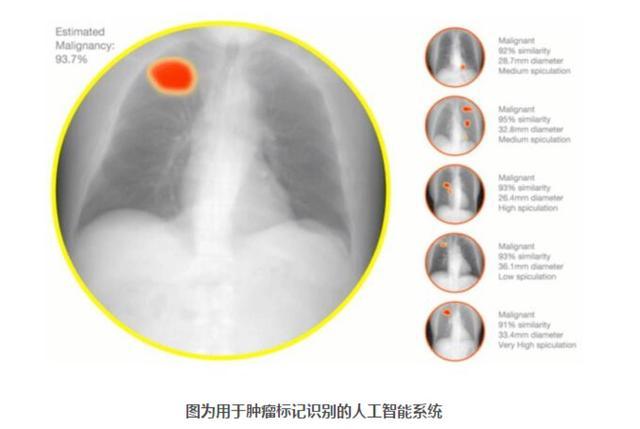 AI +医疗关乎技术与医by体育疗人文关怀的智慧医疗(图1)